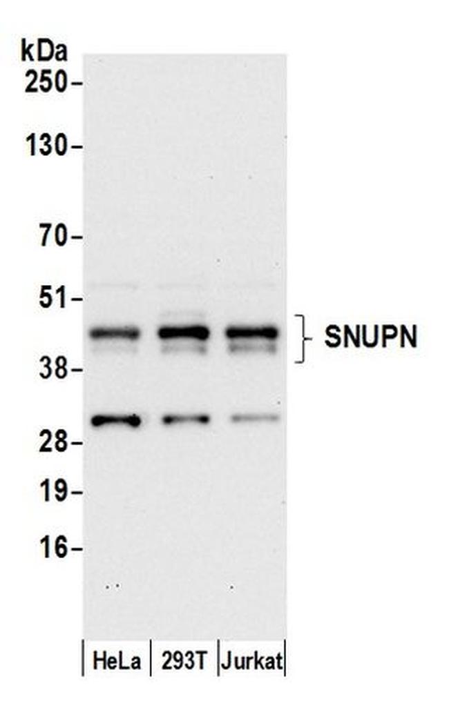 SNUPN Antibody in Western Blot (WB)