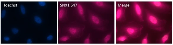 SNX1 Antibody in Immunocytochemistry (ICC/IF)