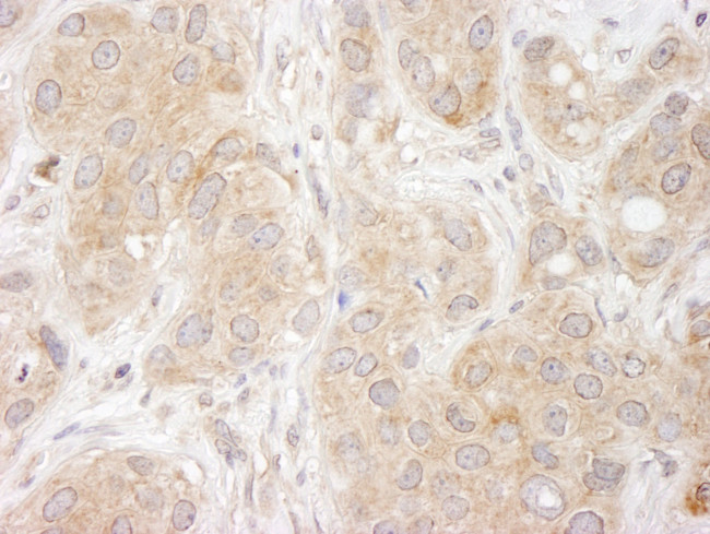 SNX1 Antibody in Immunohistochemistry (IHC)