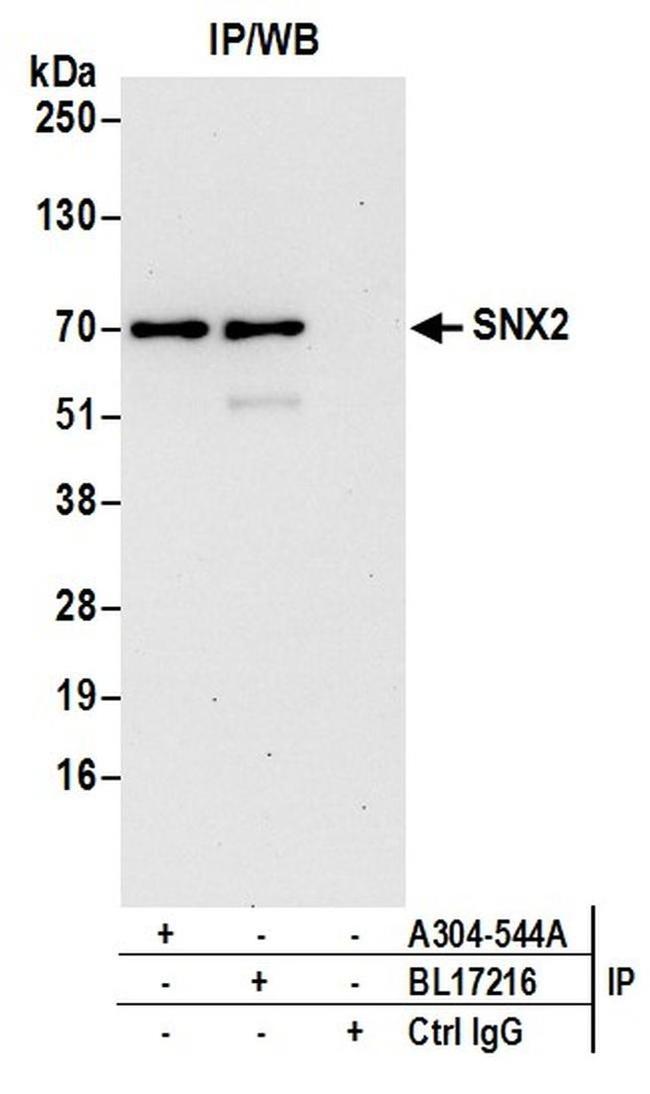 SNX2 Antibody in Western Blot (WB)