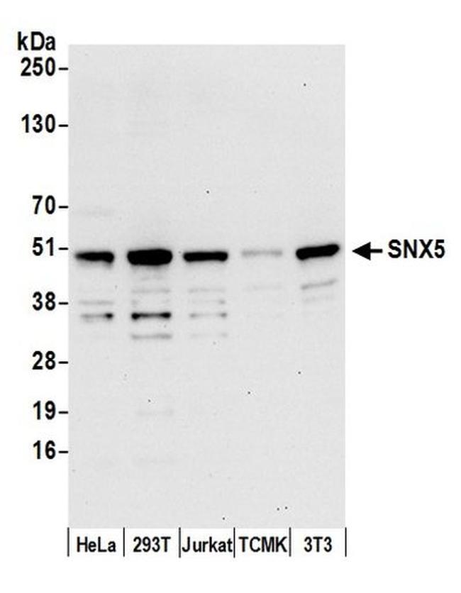 SNX5 Antibody in Western Blot (WB)