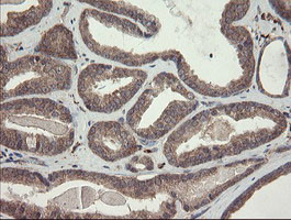 SNX8 Antibody in Immunohistochemistry (Paraffin) (IHC (P))