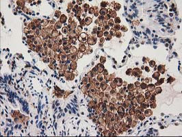 SNX8 Antibody in Immunohistochemistry (Paraffin) (IHC (P))