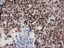 SNX8 Antibody in Immunohistochemistry (Paraffin) (IHC (P))