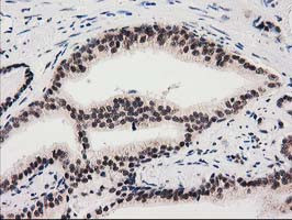 SNX8 Antibody in Immunohistochemistry (Paraffin) (IHC (P))