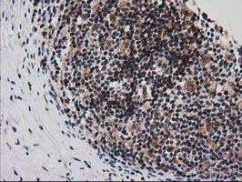 SNX8 Antibody in Immunohistochemistry (Paraffin) (IHC (P))