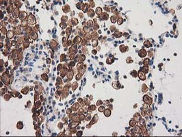 SNX8 Antibody in Immunohistochemistry (Paraffin) (IHC (P))