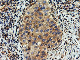 SNX8 Antibody in Immunohistochemistry (Paraffin) (IHC (P))