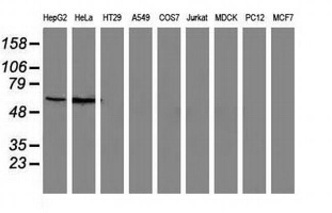 SNX8 Antibody in Western Blot (WB)