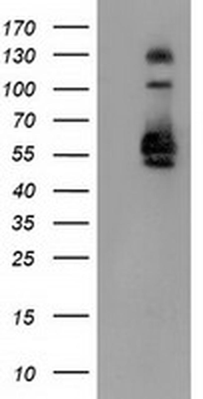 SNX8 Antibody in Western Blot (WB)