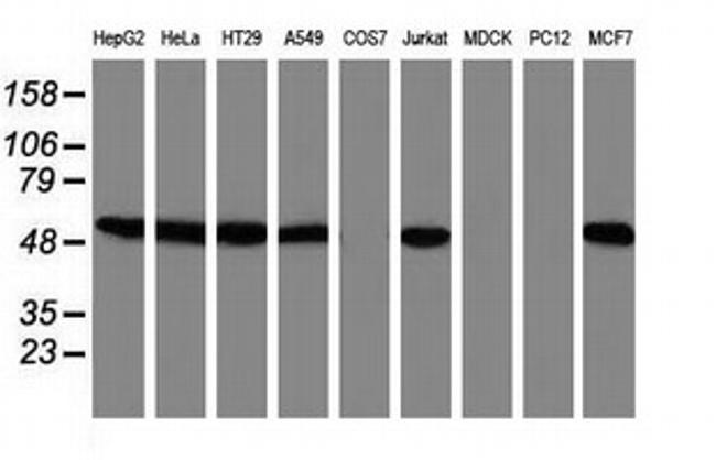 SNX8 Antibody in Western Blot (WB)