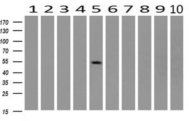 SNX8 Antibody in Western Blot (WB)