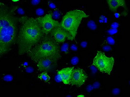 SNX9 Antibody in Immunocytochemistry (ICC/IF)