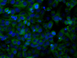 SNX9 Antibody in Immunocytochemistry (ICC/IF)