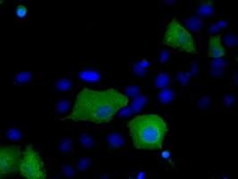 SNX9 Antibody in Immunocytochemistry (ICC/IF)