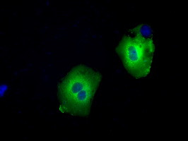 SNX9 Antibody in Immunocytochemistry (ICC/IF)