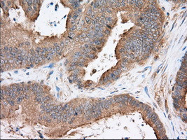 SNX9 Antibody in Immunohistochemistry (Paraffin) (IHC (P))