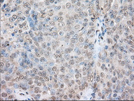 SNX9 Antibody in Immunohistochemistry (Paraffin) (IHC (P))