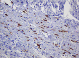 SOAT2 Antibody in Immunohistochemistry (Paraffin) (IHC (P))