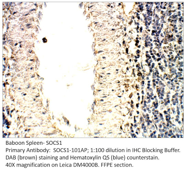 SOCS1 Antibody in Immunohistochemistry (IHC)