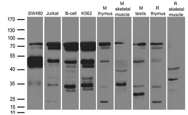 SOCS1 Antibody in Western Blot (WB)