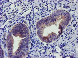 SOCS3 Antibody in Immunohistochemistry (Paraffin) (IHC (P))