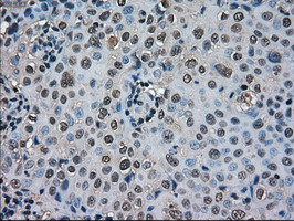 SOD1 Antibody in Immunohistochemistry (Paraffin) (IHC (P))