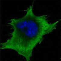 SOD1 Antibody in Immunocytochemistry (ICC/IF)