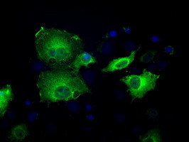 SORD Antibody in Immunocytochemistry (ICC/IF)