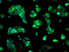 SORD Antibody in Immunocytochemistry (ICC/IF)