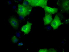 SORD Antibody in Immunocytochemistry (ICC/IF)