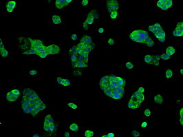 SORD Antibody in Immunocytochemistry (ICC/IF)