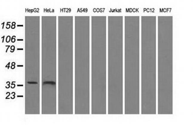 SORD Antibody in Western Blot (WB)