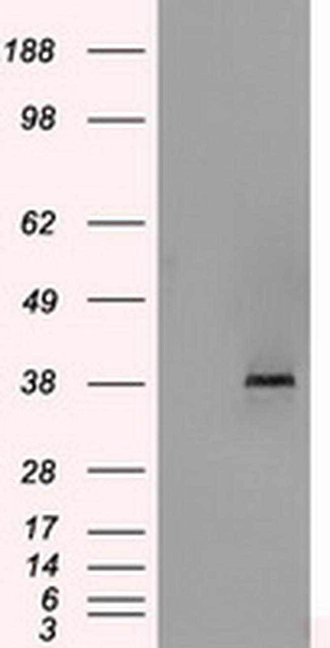 SORD Antibody in Western Blot (WB)