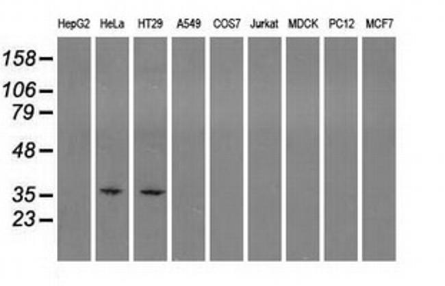 SORD Antibody in Western Blot (WB)