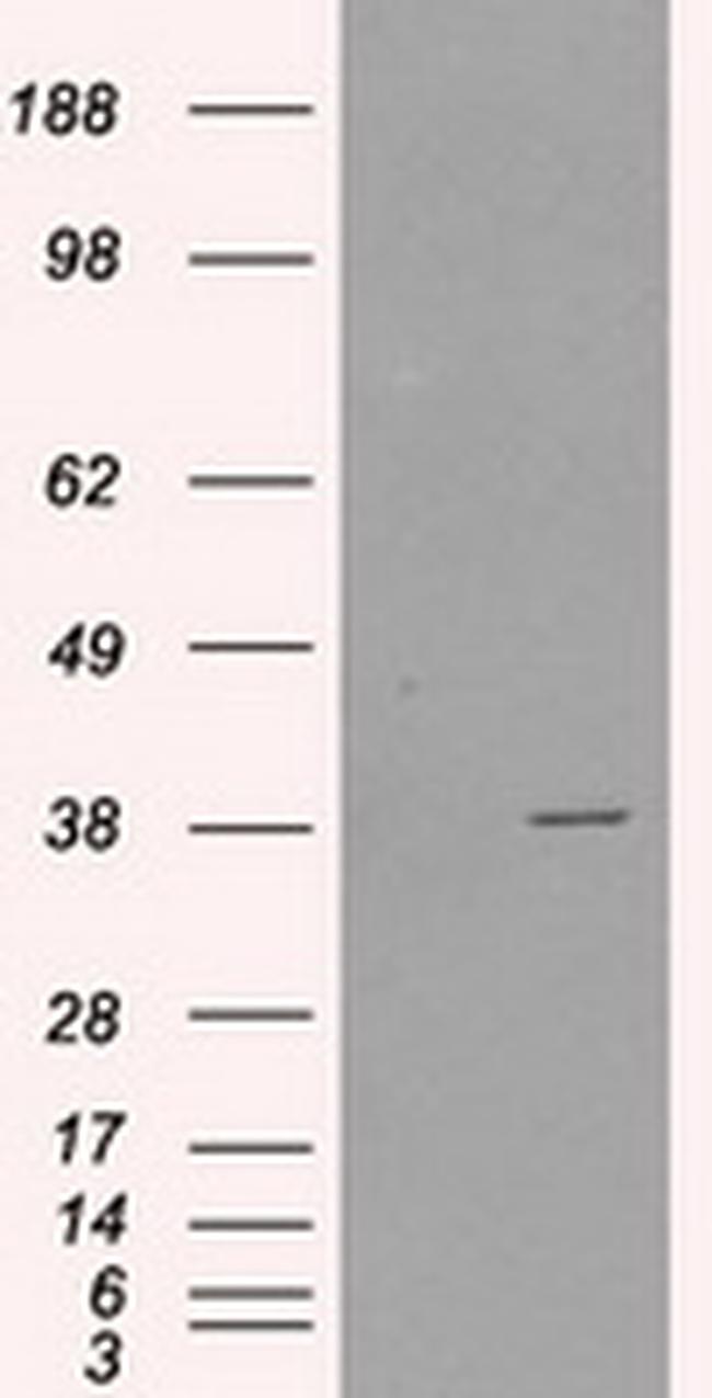 SORD Antibody in Western Blot (WB)