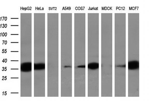 SORD Antibody in Western Blot (WB)