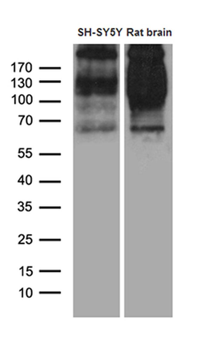 SORL1 Antibody in Western Blot (WB)