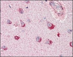 SORL1 Antibody in Immunohistochemistry (Paraffin) (IHC (P))