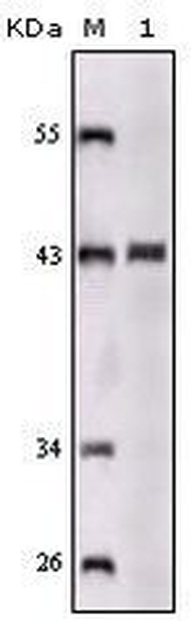 SORL1 Antibody in Western Blot (WB)