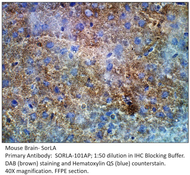 SorLA Antibody in Immunohistochemistry (IHC)