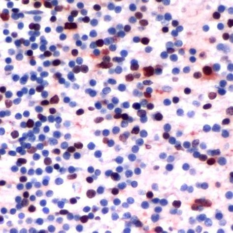 SOX2 Antibody in Immunohistochemistry (Paraffin) (IHC (P))