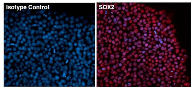 SOX2 Antibody in Immunocytochemistry (ICC/IF)