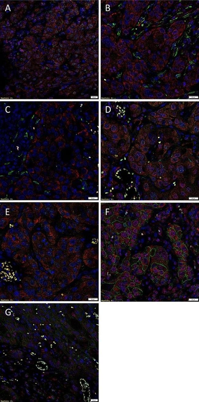 SOX2 Antibody in Immunohistochemistry (Paraffin) (IHC (P))