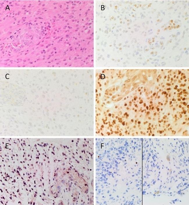 SOX2 Antibody in Immunohistochemistry (Paraffin) (IHC (P))