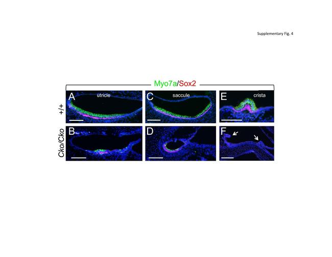 SOX2 Antibody in Immunohistochemistry (IHC)