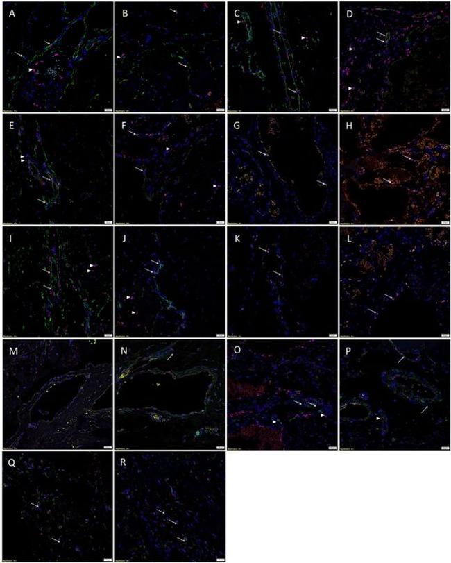 SOX2 Antibody in Immunohistochemistry (IHC)