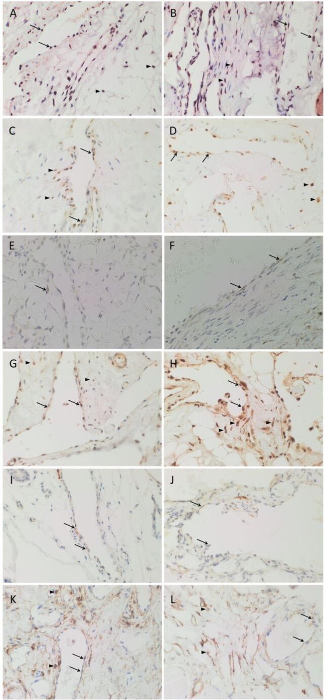 SOX2 Antibody in Immunohistochemistry (IHC)