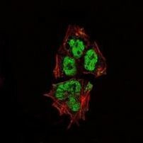 SOX2 Antibody in Immunocytochemistry (ICC/IF)