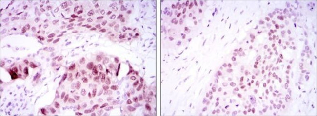 SOX2 Antibody in Immunohistochemistry (Paraffin) (IHC (P))